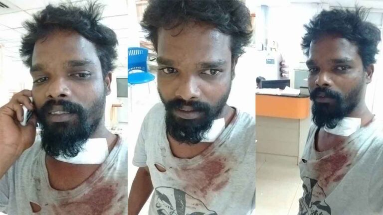Bike Rider Attacked in Kochi